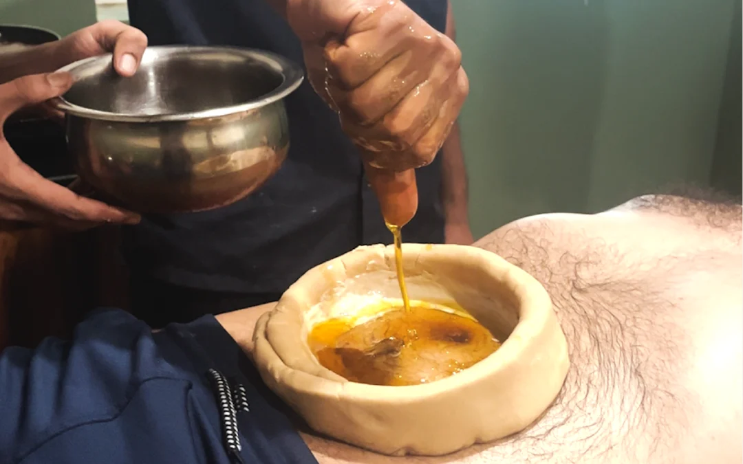 Nabhi Vasti: An Ancient Solution for Modern Gut Health
